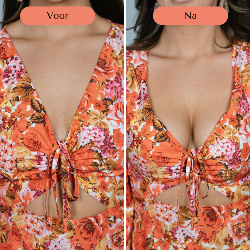 Chi Chis V-Shape Pads - Dubbelzijdig Plakkend